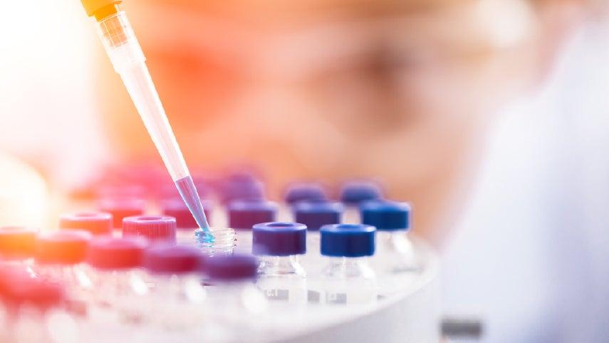 Zoomed in picture of someone dropping DNA samples into tubes.