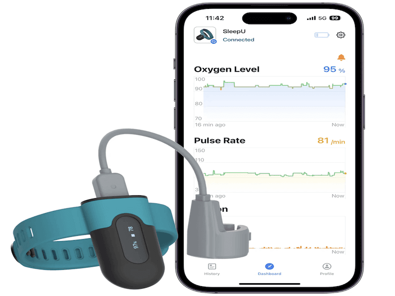 The Wellue SleepU pulse oximeter and a smartphone showing a screen with the Wellue app
