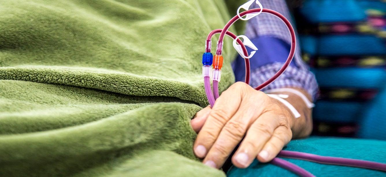 Medicare covers kidney dialysis, transplants, other services for people with End Stage Renal Disease (ESRD).